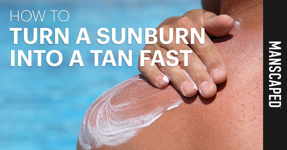 How to Turn a Sunburn into a Tan Fast